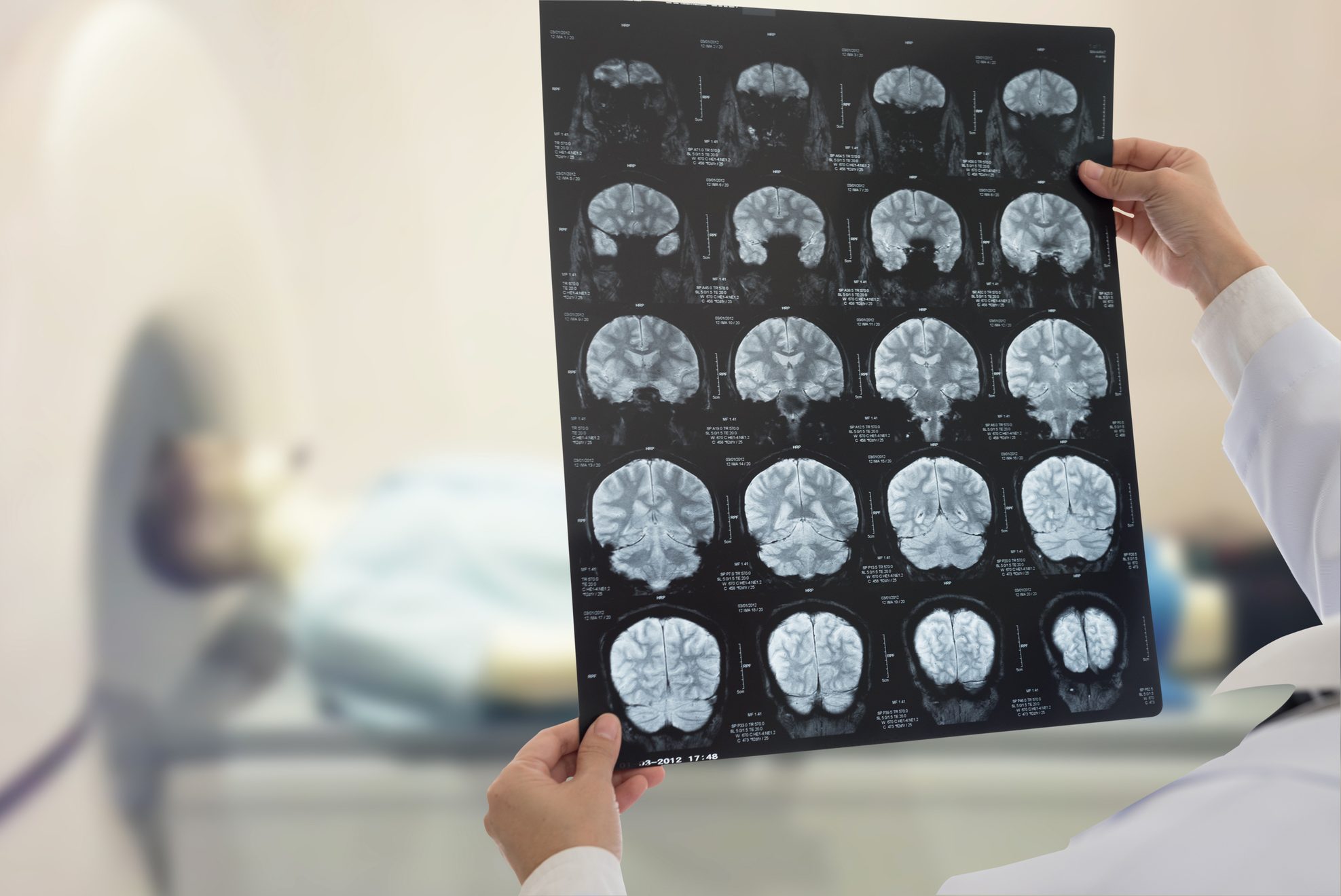 Keunggulan Magnetic Resonance Imaging (MRI) dalam Diagnosis Stroke |  Edukasi Stroke